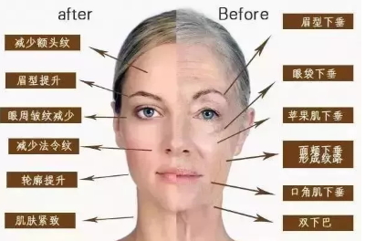 愛貝芙副作用 愛貝芙注意事項 愛貝芙副作用 愛貝芙注意事項