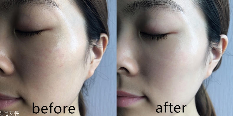 潤(rùn)百顏玻尿酸一支能兩次用嗎 潤(rùn)百顏玻尿酸效果好嗎 潤(rùn)百顏玻尿酸一支能兩次用嗎 潤(rùn)百顏玻尿酸效果好嗎