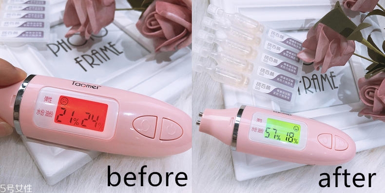 潤(rùn)百顏玻尿酸一支能兩次用嗎 潤(rùn)百顏玻尿酸效果好嗎 潤(rùn)百顏玻尿酸一支能兩次用嗎 潤(rùn)百顏玻尿酸效果好嗎