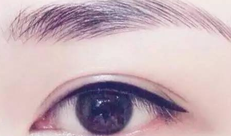 提眉和雙眼皮一起做嗎？提眉和雙眼皮要隔開多久