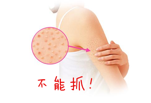 雞皮膚是怎么形成的 雞皮膚怎么根除 雞皮膚是怎么形成的 雞皮膚怎么根除