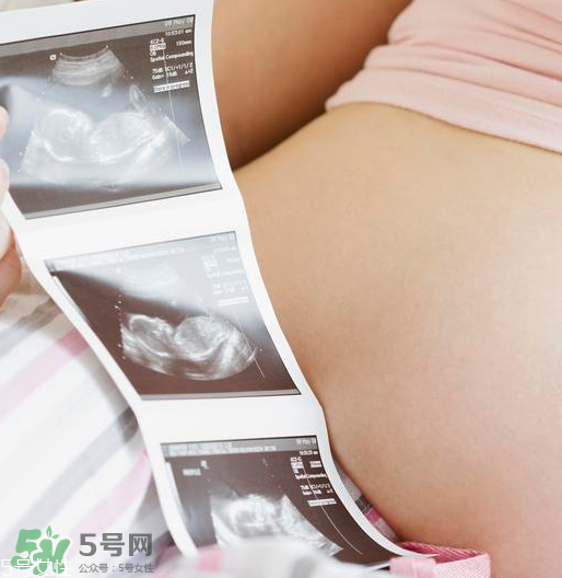 頭胎雙胞胎還能生二胎嗎？雙胞胎家庭能要二胎嗎？