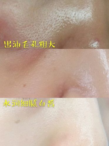 臉上怎么控油 臉上控油的方法 臉上怎么控油 臉上控油的方法