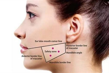 瘦臉針適合哪種臉型 瘦臉針適合多大年紀(jì)打 瘦臉針適合哪種臉型 瘦臉針適合多大年紀(jì)打