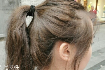 黑茶色染發(fā)劑怎么調(diào) 在家染發(fā)3步走 黑茶色染發(fā)劑怎么調(diào) 在家染發(fā)3步走