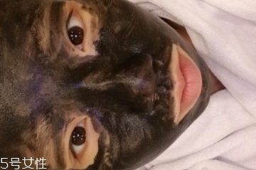 黑臉娃娃傷皮膚嗎 正規(guī)操作不會 黑臉娃娃傷皮膚嗎 正規(guī)操作不會