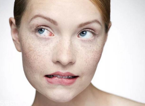 皮秒安全嗎 安全問(wèn)題不用擔(dān)心 皮秒安全嗎 安全問(wèn)題不用擔(dān)心