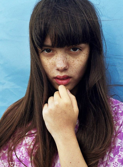 皮秒能去痘印嗎 去痘印是小意思 皮秒能去痘印嗎 去痘印是小意思