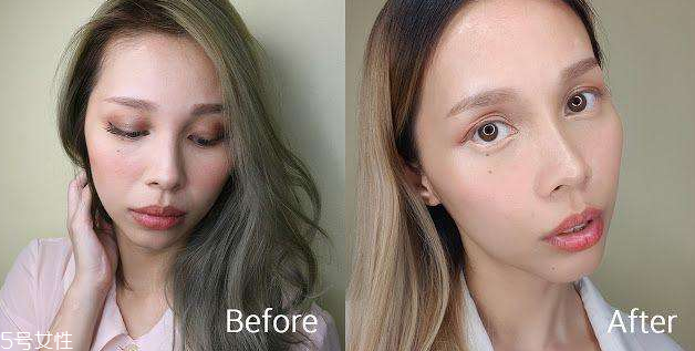 皮秒能去紅血絲嗎 效果很理想 皮秒能去紅血絲嗎 效果很理想