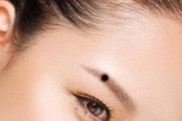 激光去痣后注意事項(xiàng)有哪些 激光去痣后注意事項(xiàng)有哪些