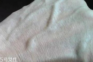 男性青筋凸起要注意 是個慢性炸彈 男性青筋凸起要注意 是個慢性炸彈