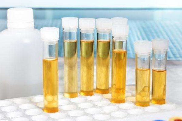 從尿液看健康 一天尿液的正常標(biāo)準(zhǔn) 從尿液看健康 一天尿液的正常標(biāo)準(zhǔn)