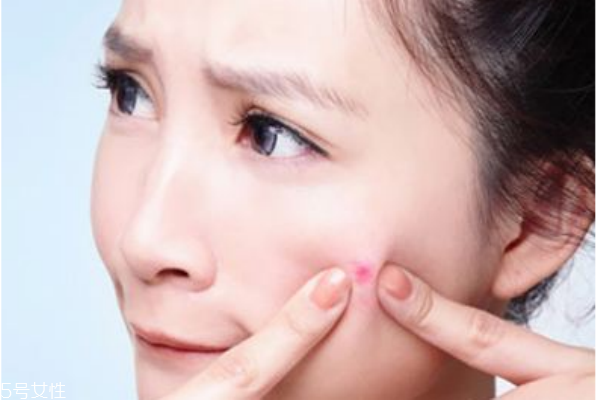 悶痘怎么才能發(fā)出來(lái) 長(zhǎng)悶痘這樣快速消除 悶痘怎么才能發(fā)出來(lái) 長(zhǎng)悶痘這樣快速消除