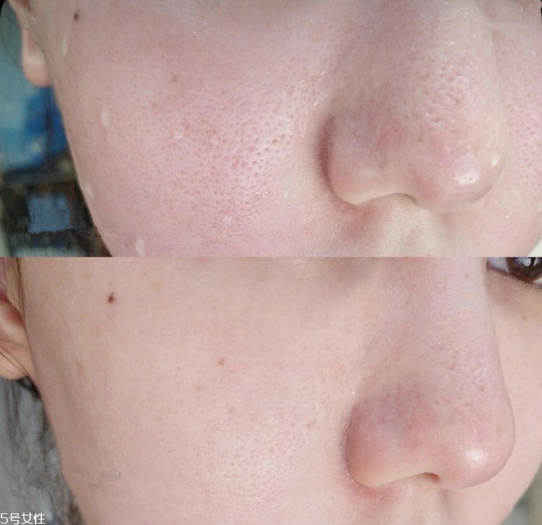 植物醫(yī)生白茶系列效果好嗎 植物醫(yī)生白茶系列油嗎 植物醫(yī)生白茶系列效果好嗎 植物醫(yī)生白茶系列油嗎