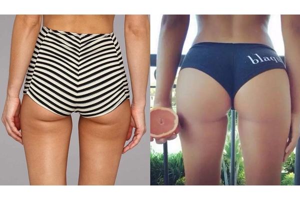 假胯寬是怎么形成的 不良走姿害了你 假胯寬是怎么形成的 不良走姿害了你