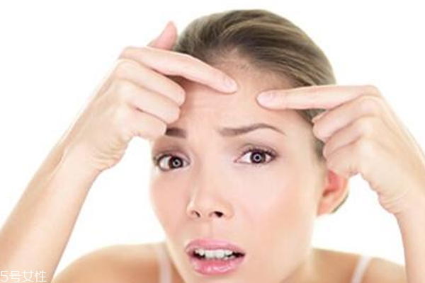 擠痘痘工具用什么好 用指甲擠會(huì)留疤 擠痘痘工具用什么好 用指甲擠會(huì)留疤