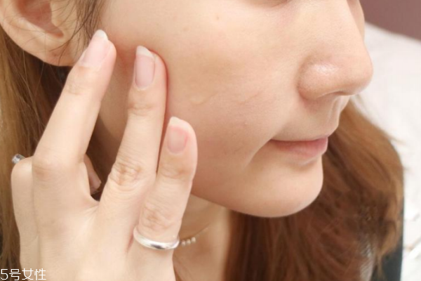 安瓶可以去細(xì)紋嗎 修復(fù)和抗老安瓶能去細(xì)紋 安瓶可以去細(xì)紋嗎 修復(fù)和抗老安瓶能去細(xì)紋