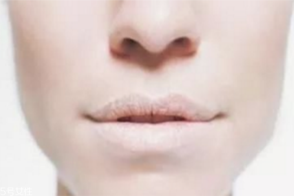 冬季如何護(hù)唇 護(hù)唇小妙招 冬季如何護(hù)唇 護(hù)唇小妙招