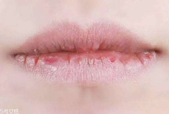 冬季如何護(hù)唇 護(hù)唇小妙招 冬季如何護(hù)唇 護(hù)唇小妙招