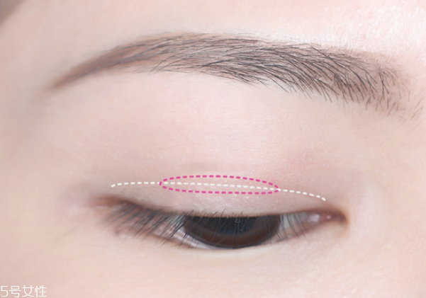 雙眼皮貼怎么選 十種雙眼皮貼全介紹 雙眼皮貼怎么選 十種雙眼皮貼全介紹