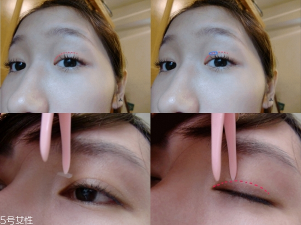 雙眼皮貼哪個(gè)牌子最好 告別無神雙眼 雙眼皮貼哪個(gè)牌子最好 告別無神雙眼