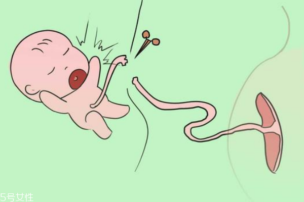 新媽媽必知:新生兒臍帶如何護理 新媽媽必知:新生兒臍帶如何護理