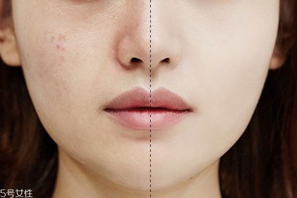 定妝噴霧怎么用效果好 3個(gè)使用方式避免糊妝 定妝噴霧怎么用效果好 3個(gè)使用方式避免糊妝
