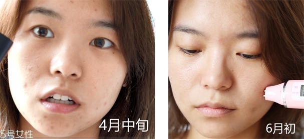 自然之名酵母水安全嗎 自然之名酵母水成分 自然之名酵母水安全嗎 自然之名酵母水成分