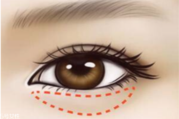 去除魚尾紋眼袋的妙方 眼霜錯(cuò)誤的涂法 去除魚尾紋眼袋的妙方 眼霜錯(cuò)誤的涂法