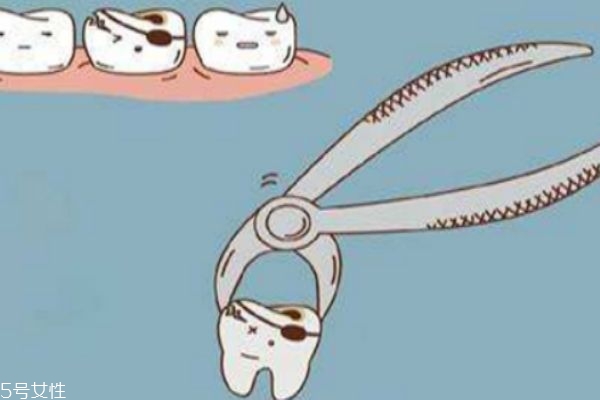 拔牙幾天能好 拔牙會(huì)改變臉型嗎 拔牙幾天能好 拔牙會(huì)改變臉型嗎