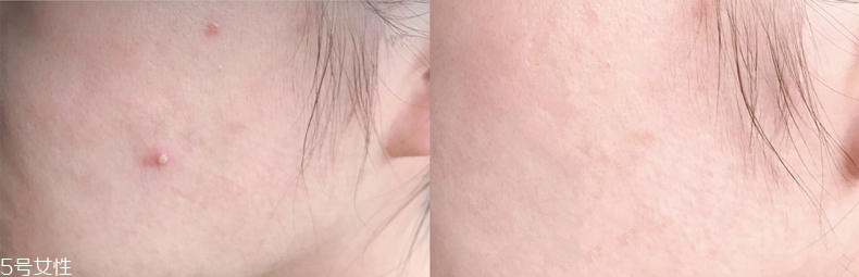 2019醫(yī)美面膜哪個牌子好 5大熱門醫(yī)美面膜pk 2019醫(yī)美面膜哪個牌子好 5大熱門醫(yī)美面膜pk