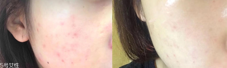 2019醫(yī)美面膜哪個牌子好 5大熱門醫(yī)美面膜pk 2019醫(yī)美面膜哪個牌子好 5大熱門醫(yī)美面膜pk