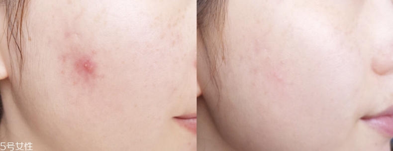 2019醫(yī)美面膜哪個牌子好 5大熱門醫(yī)美面膜pk 2019醫(yī)美面膜哪個牌子好 5大熱門醫(yī)美面膜pk