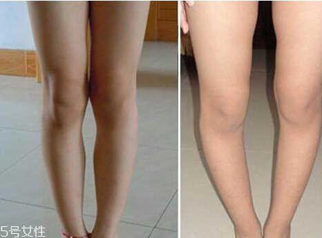 什么樣的腿算長 你知道怎樣是真正的腿精 什么樣的腿算長 你知道怎樣是真正的腿精