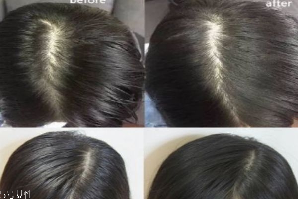 碧緹絲免洗噴霧有害嗎 只能用來急救解決小尷尬 碧緹絲免洗噴霧有害嗎 只能用來急救解決小尷尬