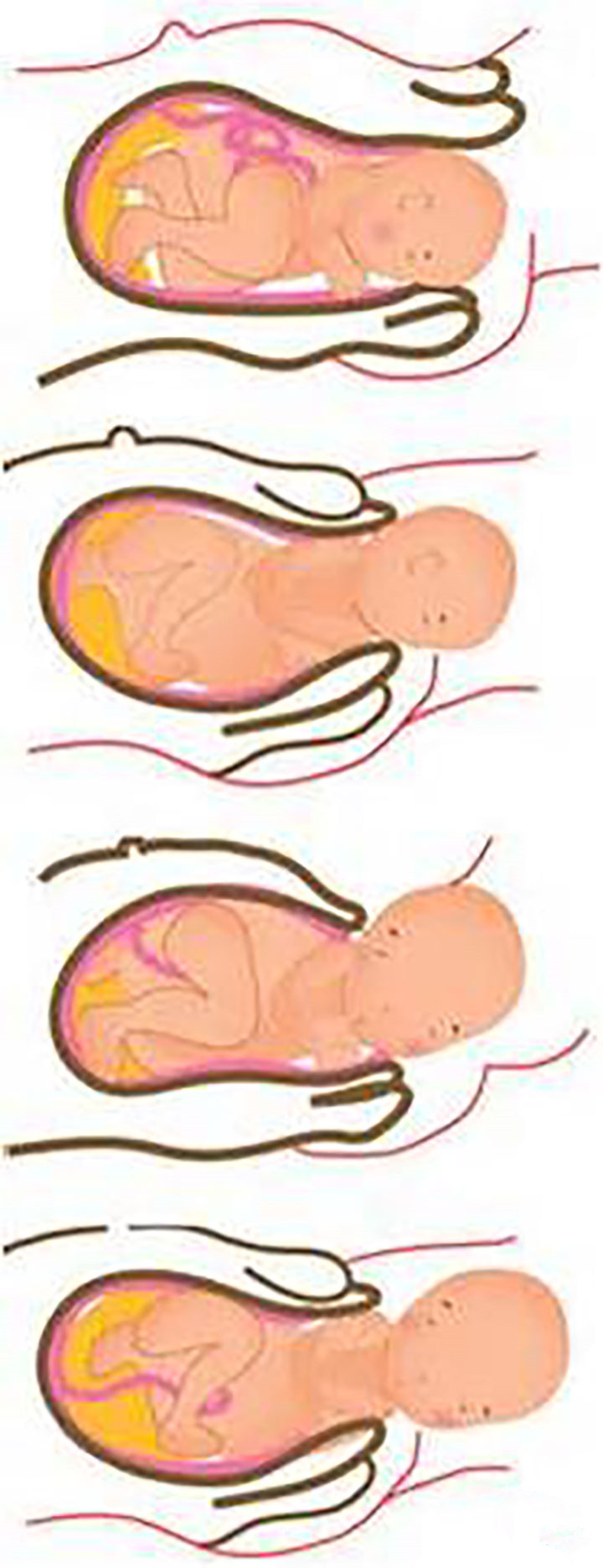 分娩前的征兆都有哪些 陣痛見紅破水三大癥狀 分娩前的征兆都有哪些 陣痛見紅破水三大癥狀