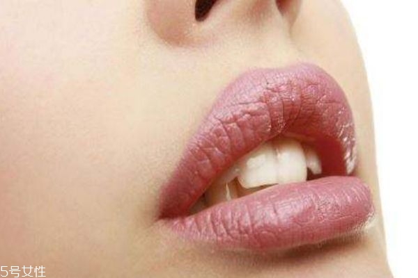 嘴巴長(zhǎng)皰疹怎么辦 有可能引發(fā)這些疾病 嘴巴長(zhǎng)皰疹怎么辦 有可能引發(fā)這些疾病