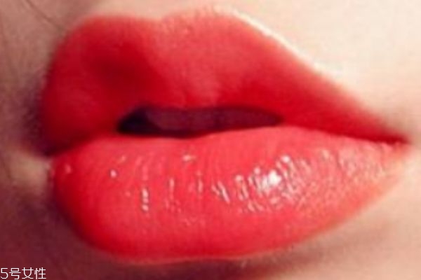 嘴巴長皰疹怎么辦 有可能引發(fā)這些疾病 嘴巴長皰疹怎么辦 有可能引發(fā)這些疾病