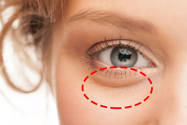 怎么區(qū)分脂肪粒和閉口 脂肪粒和閉口的區(qū)別 怎么區(qū)分脂肪粒和閉口 脂肪粒和閉口的區(qū)別