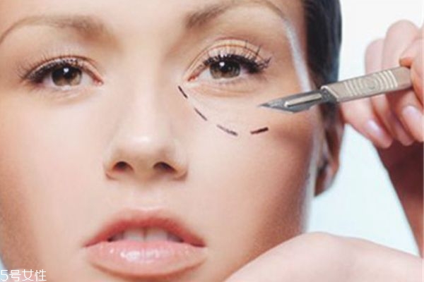 怎么樣祛除眼袋 預(yù)防眼袋好方法 怎么樣祛除眼袋 預(yù)防眼袋好方法