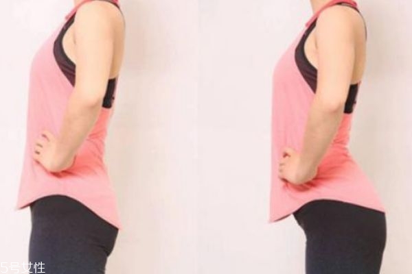 骨盆前傾的癥狀 骨盆前傾的自測辦法 骨盆前傾的癥狀 骨盆前傾的自測辦法