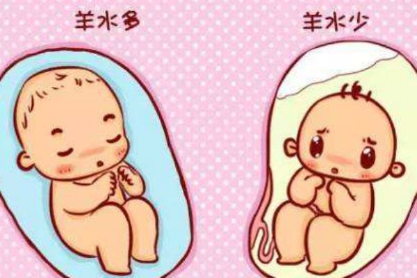 孕婦羊水過多什么癥狀 媽媽們要注意 孕婦羊水過多什么癥狀 媽媽們要注意