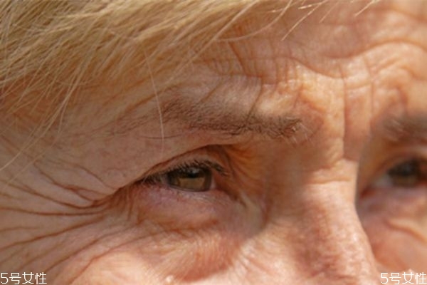 消除眼部皺紋的方法 簡單有效的眼部去皺偏方 消除眼部皺紋的方法 簡單有效的眼部去皺偏方