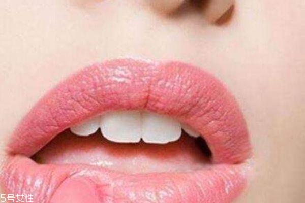 唇紋可以去除嗎 唇紋該如何淡化 唇紋可以去除嗎 唇紋該如何淡化