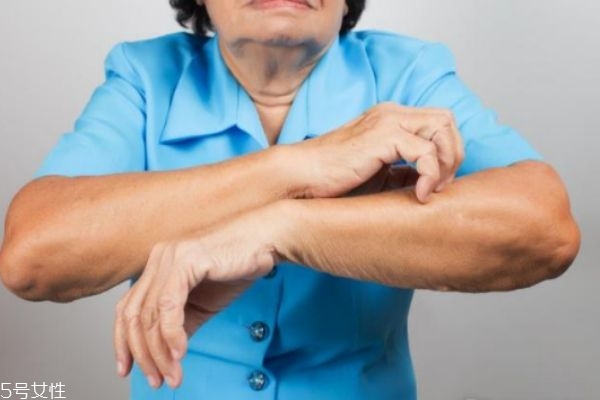 一到冬天皮膚就發(fā)癢是皮膚病嗎 可能和這有關(guān) 一到冬天皮膚就發(fā)癢是皮膚病嗎 可能和這有關(guān)