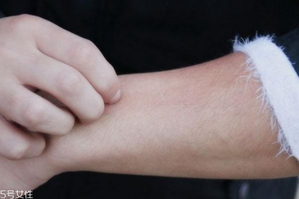 一到冬天皮膚就發(fā)癢是皮膚病嗎 可能和這有關(guān) 一到冬天皮膚就發(fā)癢是皮膚病嗎 可能和這有關(guān)