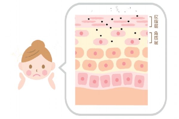 敏感肌膚怎么修復(fù)好 敏感皮膚需要注意哪些事項 敏感肌膚怎么修復(fù)好 敏感皮膚需要注意哪些事項