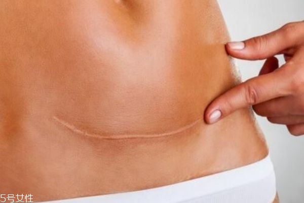 百洛油的功效 百洛油的隱藏技能 百洛油的功效 百洛油的隱藏技能