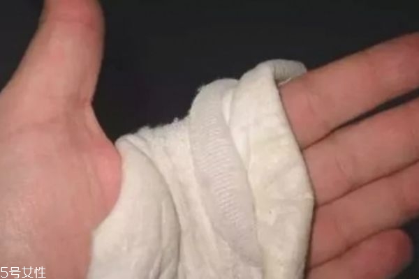 燙傷后的黑印會(huì)消退嗎 需要較長時(shí)間 燙傷后的黑印會(huì)消退嗎 需要較長時(shí)間