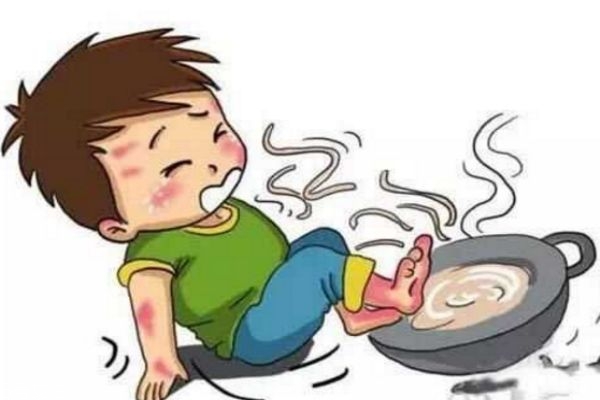 燙傷后的水泡能挑破嗎 怎樣挑破水泡才不容易引起感染 燙傷后的水泡能挑破嗎 怎樣挑破水泡才不容易引起感染